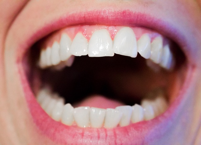 higiene-dental